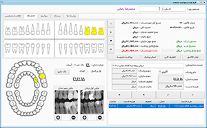 با قابلیت نصب پرینتر صنعتی ، کامپیوتر ، مانیتور مالتی تاچ 17 اینچ ، پوز بانک ، کارتخوان و بلندگو